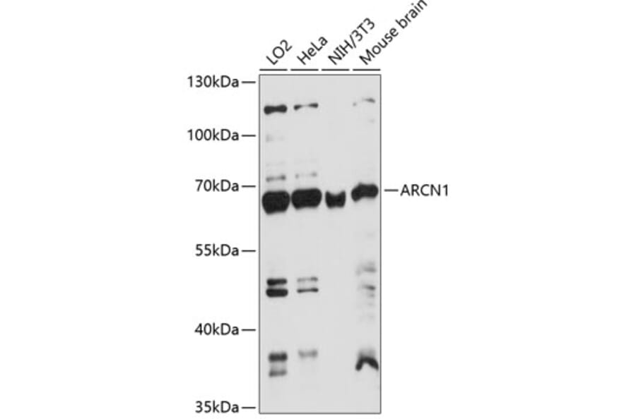 Western Blot - Anti-Coatomer subunit delta/COPD Antibody (A90834) - Antibodies.com