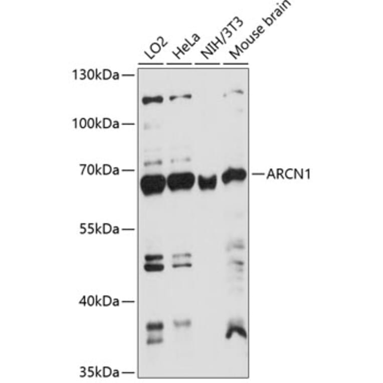 Western Blot - Anti-Coatomer subunit delta/COPD Antibody (A90834) - Antibodies.com