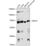 Western Blot - Anti-Coatomer subunit delta/COPD Antibody (A90834) - Antibodies.com