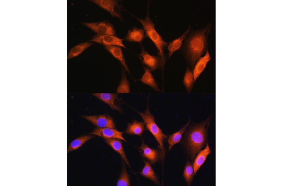 Immunofluorescence - Anti-Coatomer subunit delta/COPD Antibody (A90834) - Antibodies.com