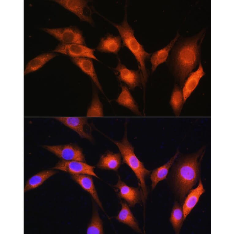 Immunofluorescence - Anti-Coatomer subunit delta/COPD Antibody (A90834) - Antibodies.com