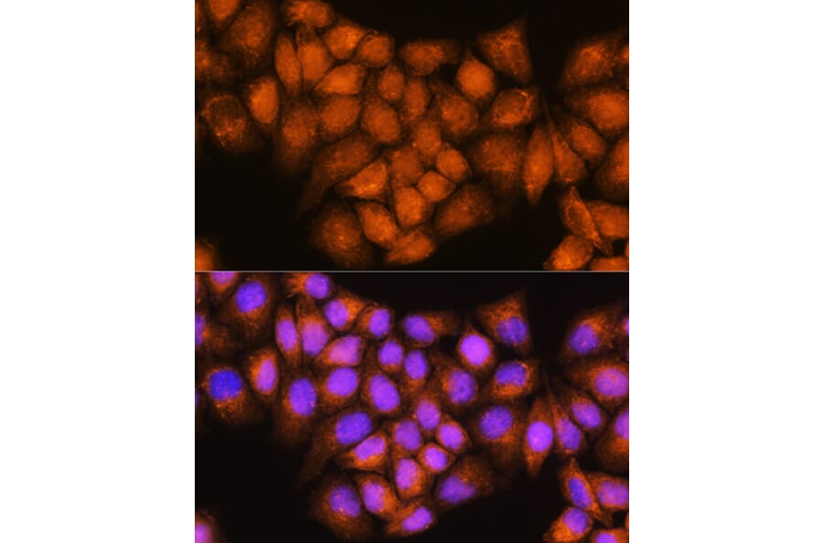 Immunofluorescence - Anti-Coatomer subunit delta/COPD Antibody (A90834) - Antibodies.com