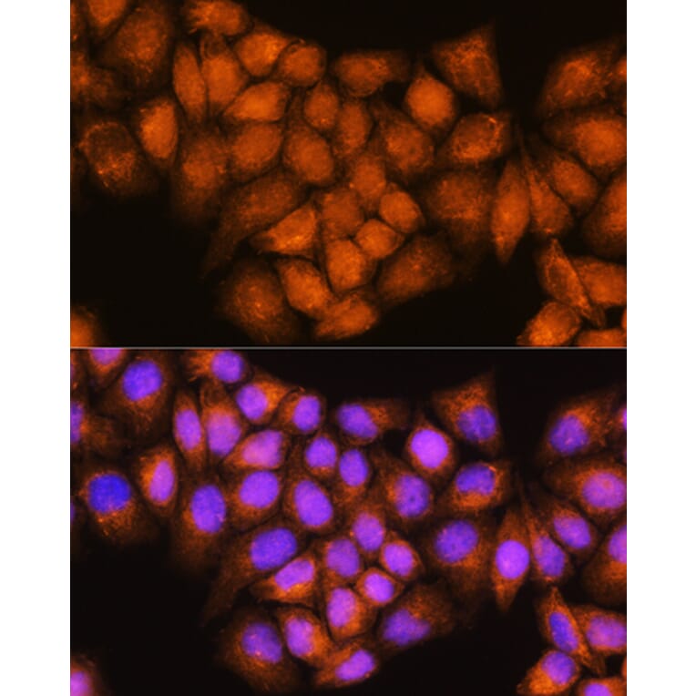 Immunofluorescence - Anti-Coatomer subunit delta/COPD Antibody (A90834) - Antibodies.com