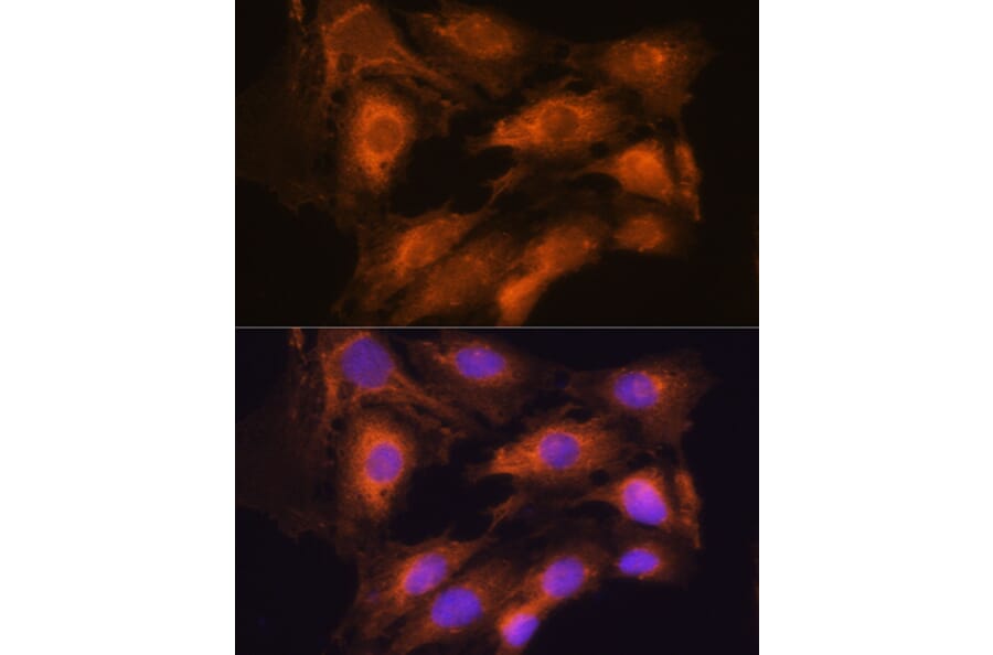 Immunofluorescence - Anti-Coatomer subunit delta/COPD Antibody (A90834) - Antibodies.com