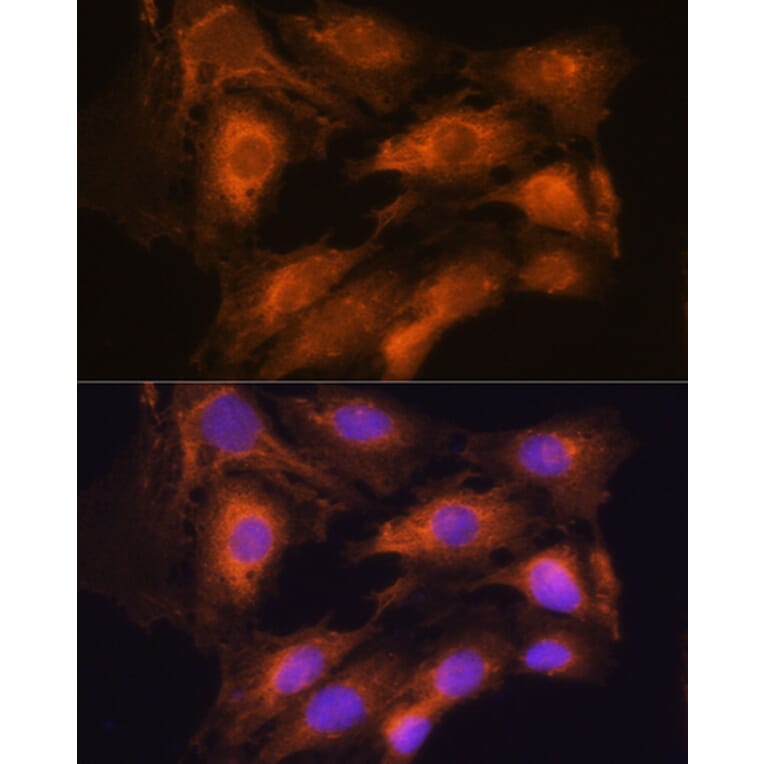 Immunofluorescence - Anti-Coatomer subunit delta/COPD Antibody (A90834) - Antibodies.com