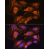 Immunofluorescence - Anti-Coatomer subunit delta/COPD Antibody (A90834) - Antibodies.com