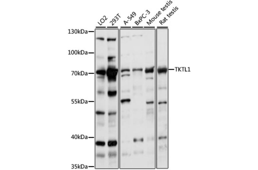 Western Blot - Anti-TKTL1/TKR Antibody (A90835) - Antibodies.com