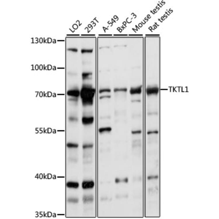 Western Blot - Anti-TKTL1/TKR Antibody (A90835) - Antibodies.com
