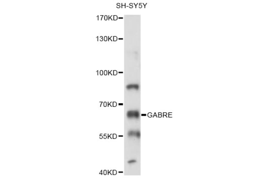 Western Blot - Anti-GABRE Antibody (A14239) - Antibodies.com