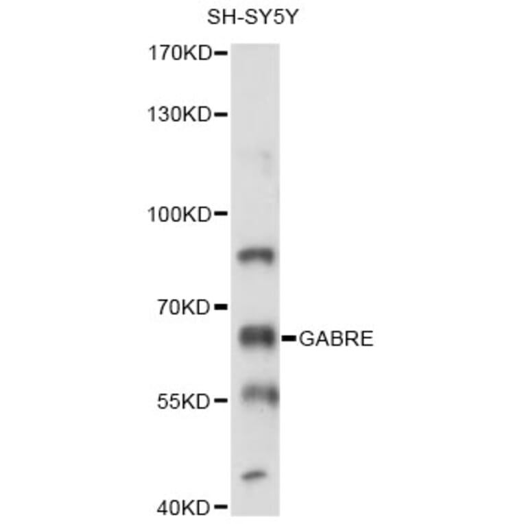 Western Blot - Anti-GABRE Antibody (A14239) - Antibodies.com