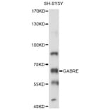 Western Blot - Anti-GABRE Antibody (A14239) - Antibodies.com