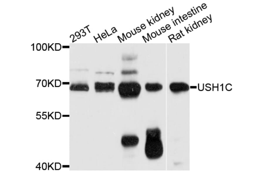 Western Blot - Anti-USH1C Antibody (A12556) - Antibodies.com
