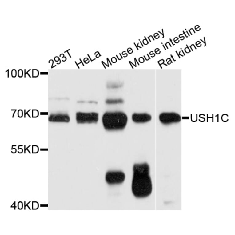 Western Blot - Anti-USH1C Antibody (A12556) - Antibodies.com
