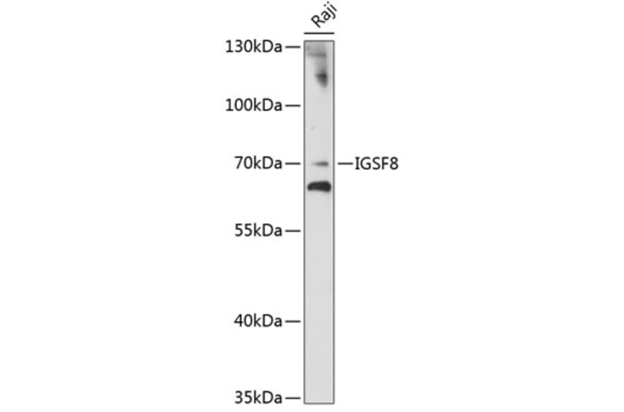 Western Blot - Anti-EWI-2 Antibody (A90839) - Antibodies.com