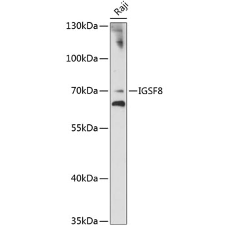 Western Blot - Anti-EWI-2 Antibody (A90839) - Antibodies.com