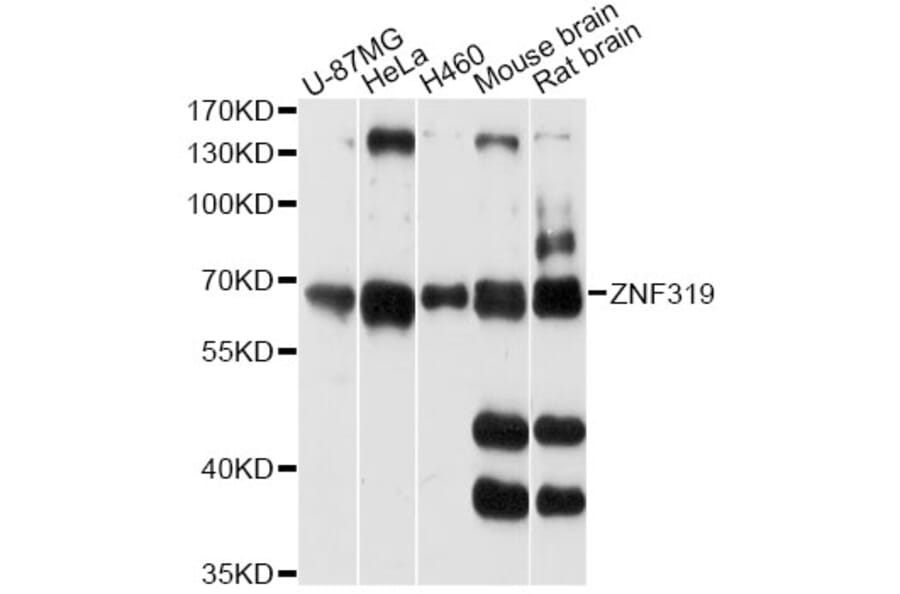Western Blot - Anti-ZNF319 Antibody (A14324) - Antibodies.com