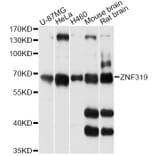 Western Blot - Anti-ZNF319 Antibody (A14324) - Antibodies.com