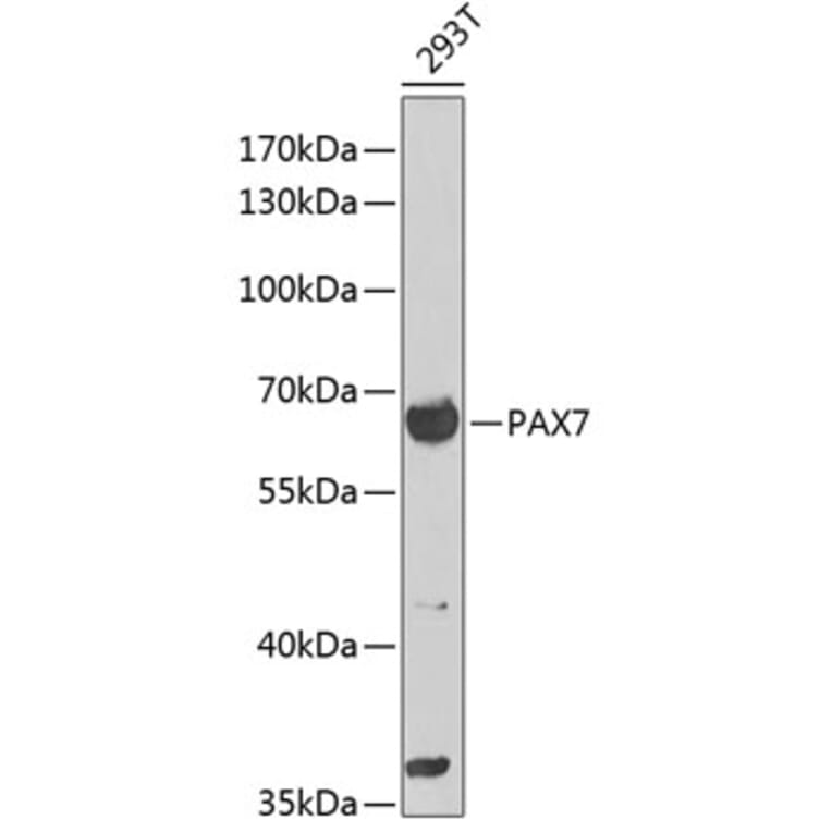 Western Blot - Anti-PAX7 Antibody (A12740) - Antibodies.com