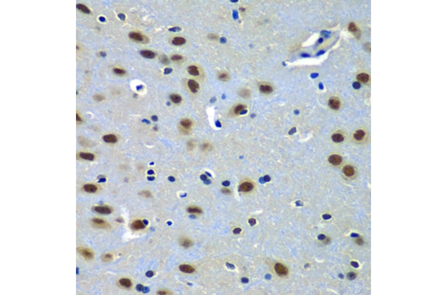 Immunohistochemistry - Anti-PAX7 Antibody (A12740) - Antibodies.com