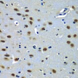 Immunohistochemistry - Anti-PAX7 Antibody (A12740) - Antibodies.com