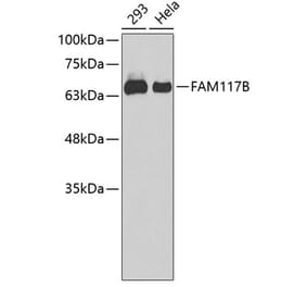 Western Blot - Anti-FAM117B Antibody (A90842) - Antibodies.com