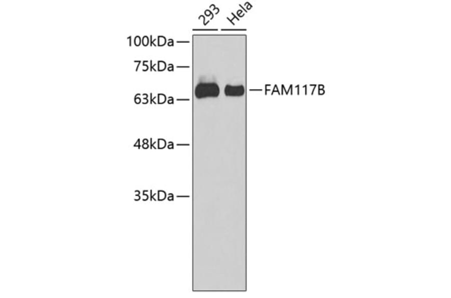 Western Blot - Anti-FAM117B Antibody (A90842) - Antibodies.com