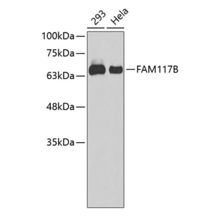 Western Blot - Anti-FAM117B Antibody (A90842) - Antibodies.com