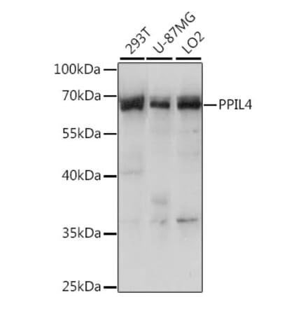 Western Blot - Anti-PPIL4 Antibody (A90843) - Antibodies.com