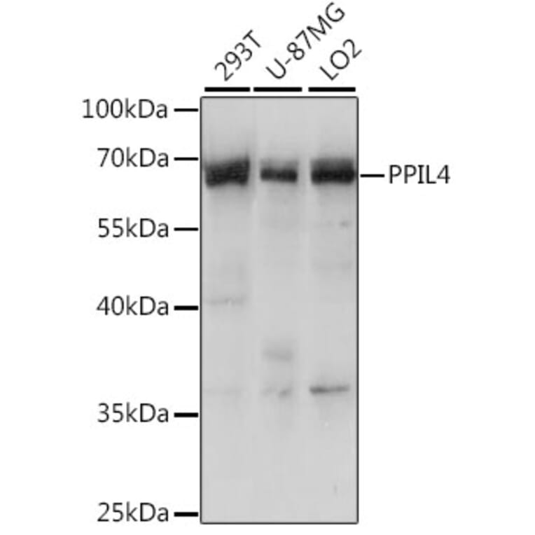 Western Blot - Anti-PPIL4 Antibody (A90843) - Antibodies.com