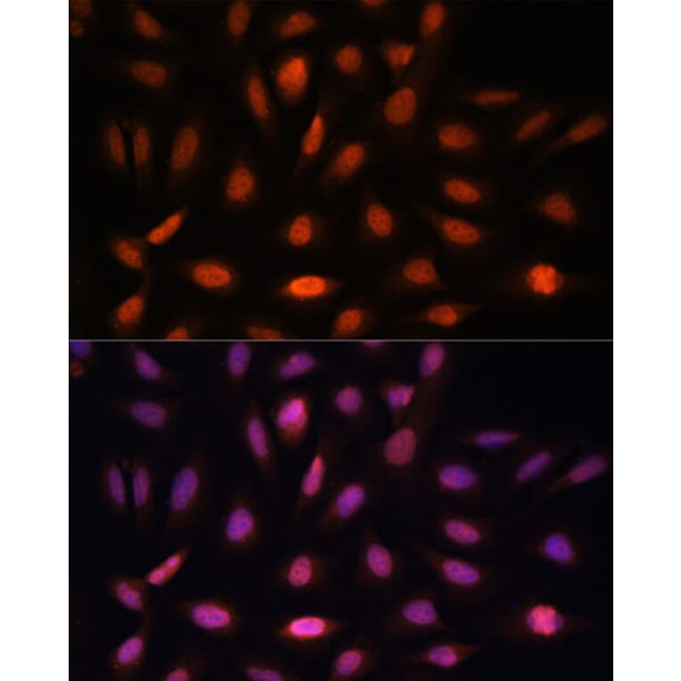 Immunofluorescence - Anti-PPIL4 Antibody (A90843) - Antibodies.com