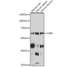 Western Blot - Anti-CD86 Antibody (A90844) - Antibodies.com