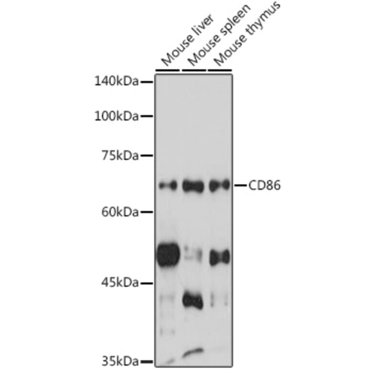 Western Blot - Anti-CD86 Antibody (A90844) - Antibodies.com