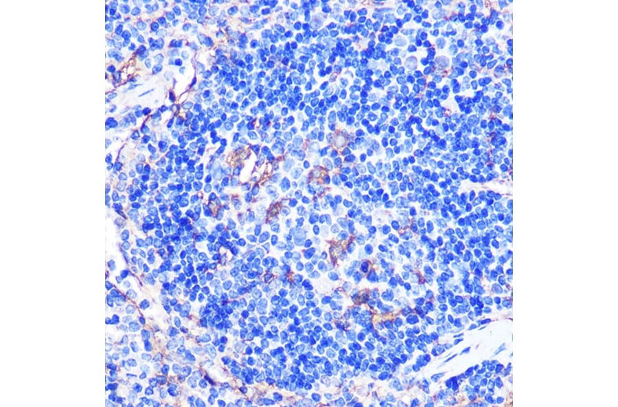 Immunohistochemistry - Anti-CD86 Antibody (A90844) - Antibodies.com