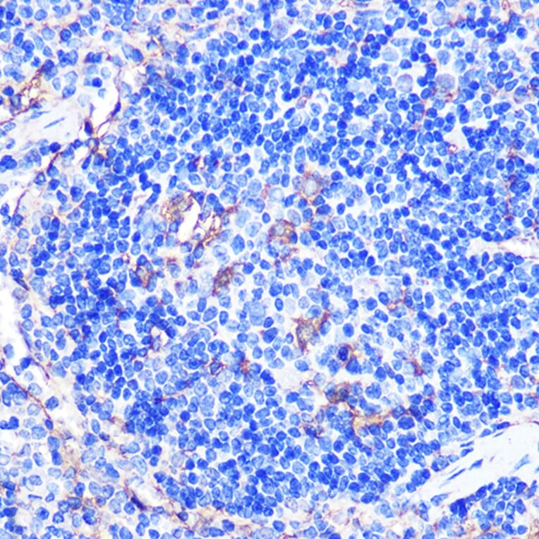 Immunohistochemistry - Anti-CD86 Antibody (A90844) - Antibodies.com