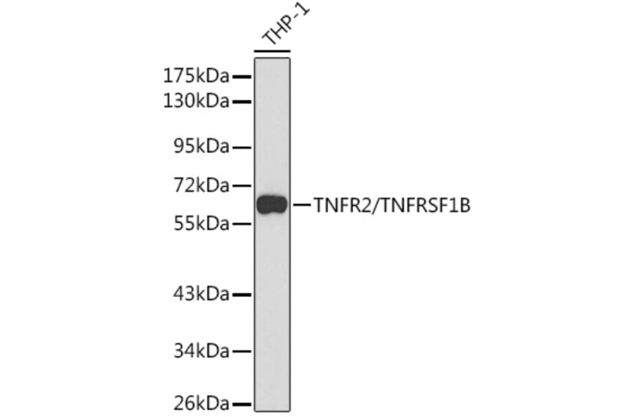 Western Blot - Anti-TNF Receptor II Antibody (A90845) - Antibodies.com