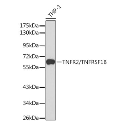Western Blot - Anti-TNF Receptor II Antibody (A90845) - Antibodies.com