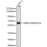 Western Blot - Anti-TNF Receptor II Antibody (A90845) - Antibodies.com