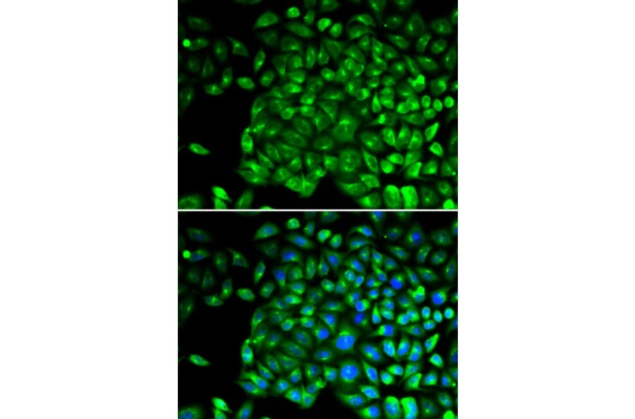 Immunofluorescence - Anti-TNF Receptor II Antibody (A90845) - Antibodies.com