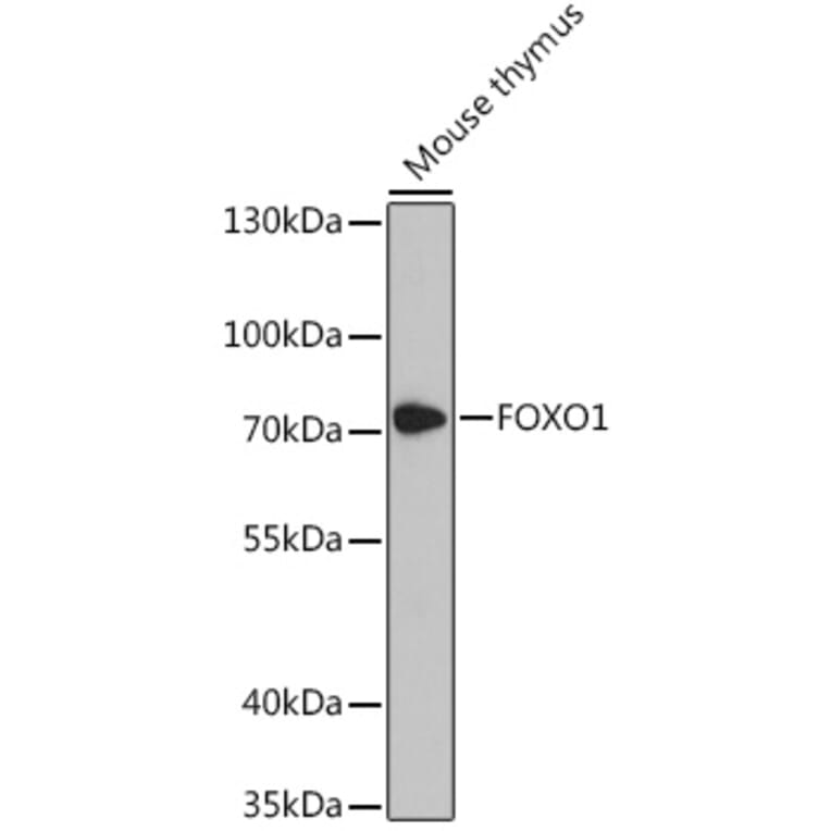 Western Blot - Anti-FOXO1A Antibody (A90846) - Antibodies.com