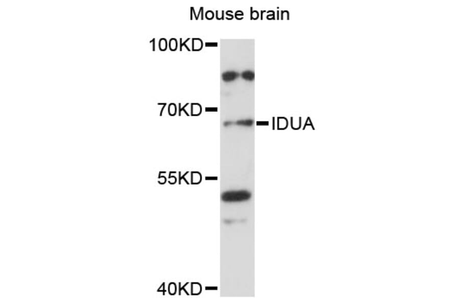 Western Blot - Anti-IDUA Antibody (A13779) - Antibodies.com