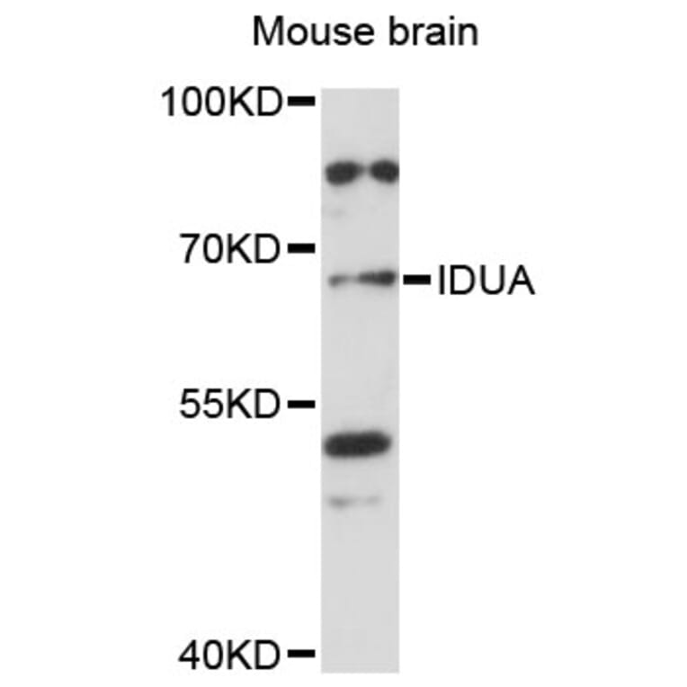 Western Blot - Anti-IDUA Antibody (A13779) - Antibodies.com