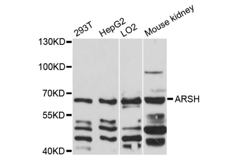 Western Blot - Anti-ARSH Antibody (A12664) - Antibodies.com