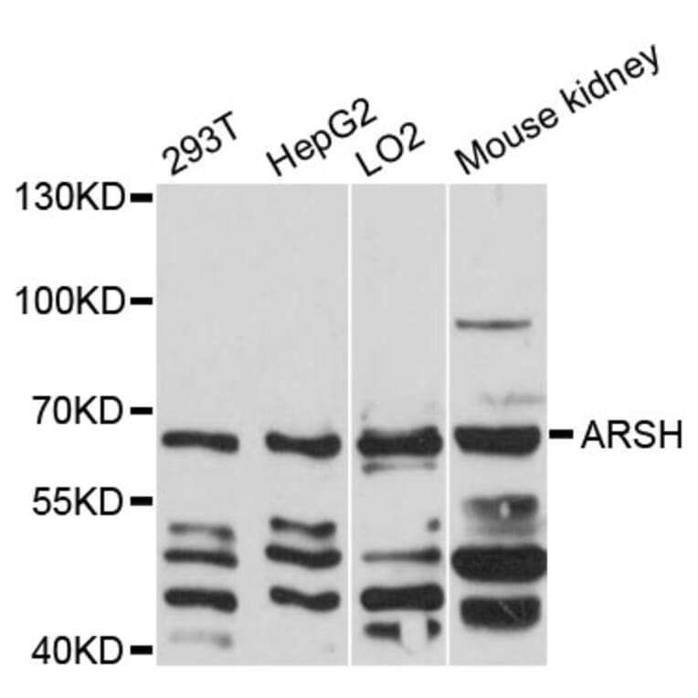 Western Blot - Anti-ARSH Antibody (A12664) - Antibodies.com