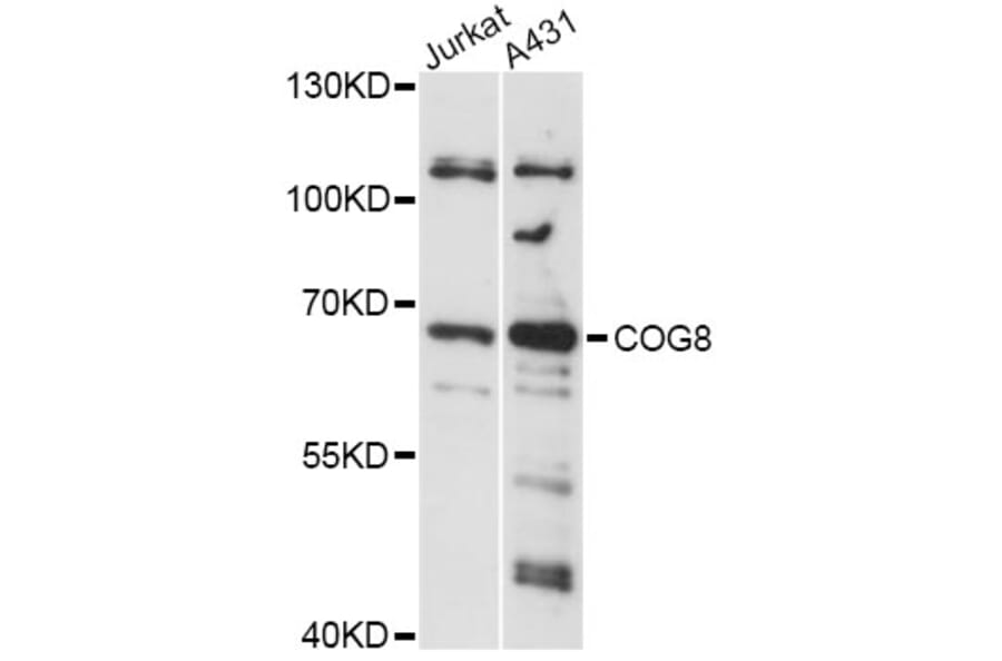 Western Blot - Anti-COG8 Antibody (A14361) - Antibodies.com