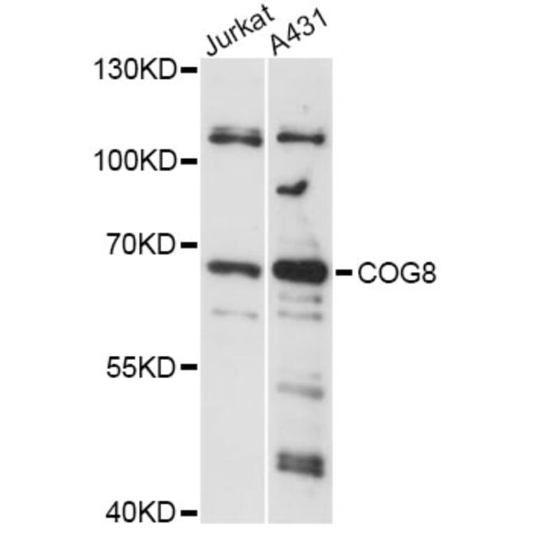 Western Blot - Anti-COG8 Antibody (A14361) - Antibodies.com
