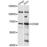 Western Blot - Anti-COG8 Antibody (A14361) - Antibodies.com