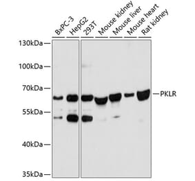 Western Blot - Anti-PKLR Antibody (A90852) - Antibodies.com