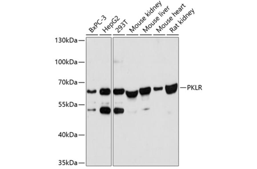 Western Blot - Anti-PKLR Antibody (A90852) - Antibodies.com
