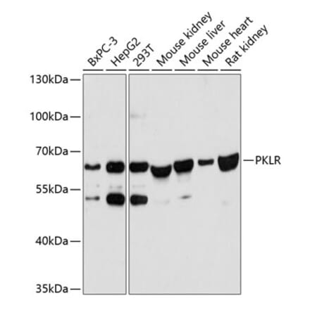 Western Blot - Anti-PKLR Antibody (A90852) - Antibodies.com