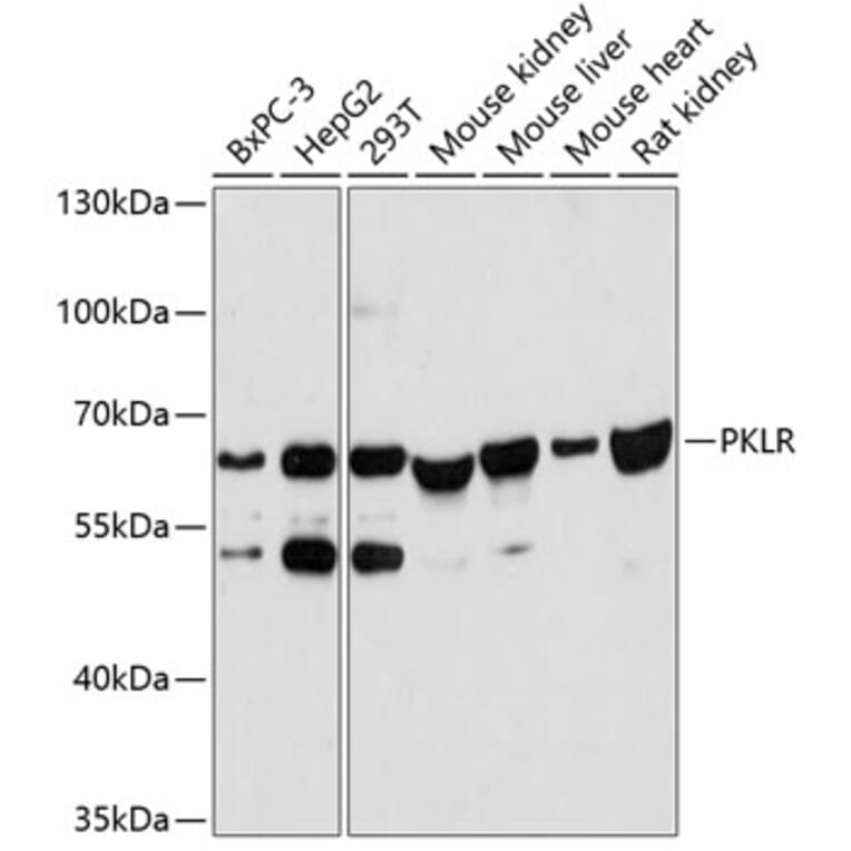 Western Blot - Anti-PKLR Antibody (A90852) - Antibodies.com